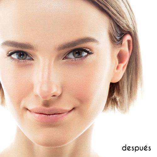 Corrector de imperfecciones - Zit Zapper 2.3g correctores de maquillaje Couleur Caramel 